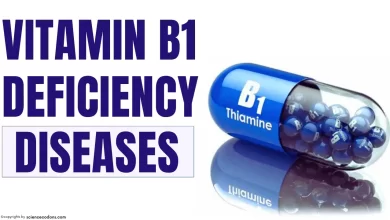 Vitamin B1(thiamine) deficiency diseases