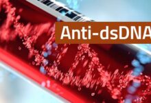 anti dsdna