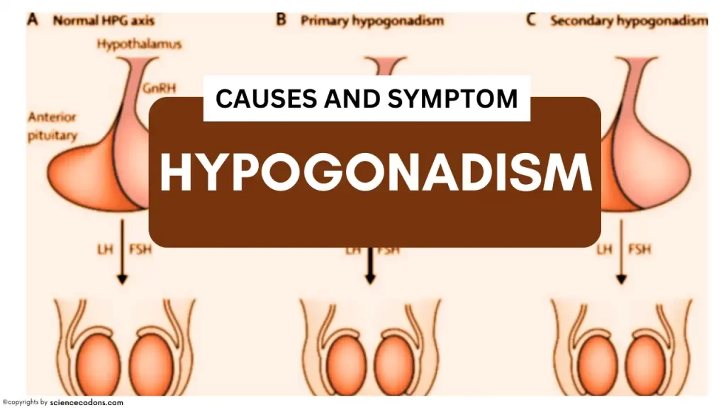 hypogonadism causes and symptoms
