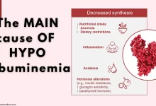 the main cause of hypoalbuminemia