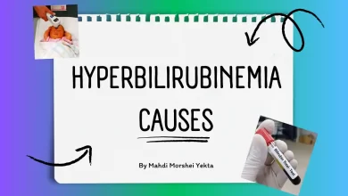 Hyperbilirubinemia causes