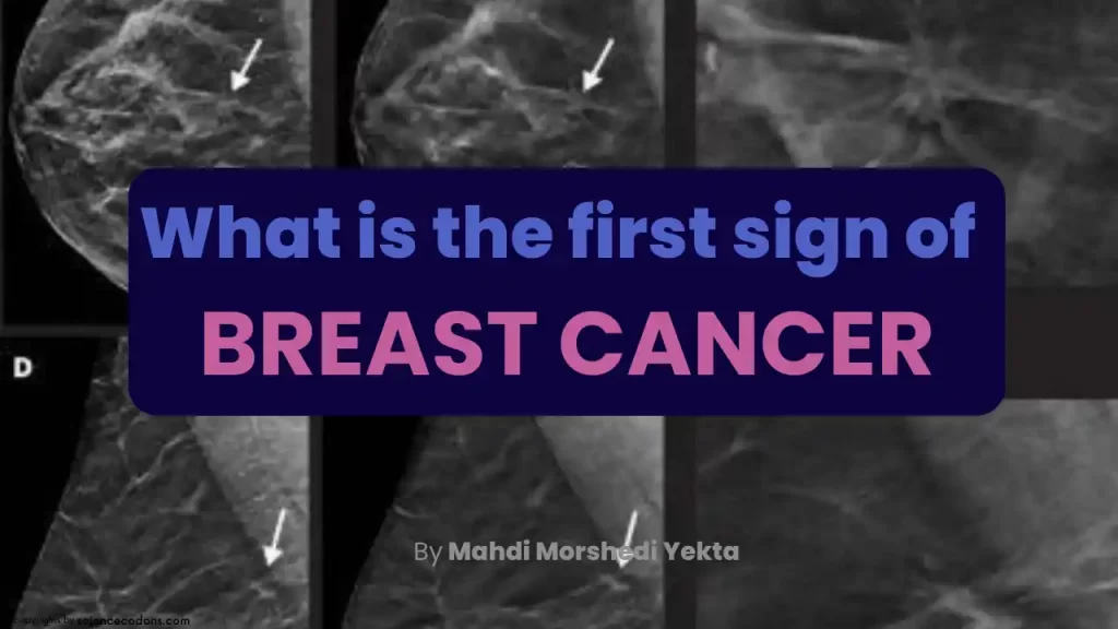 What is the first sign of breast cancer