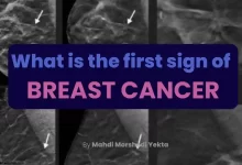 What is the first sign of breast cancer