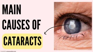 main causes of cataracts