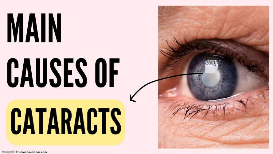 main causes of cataracts