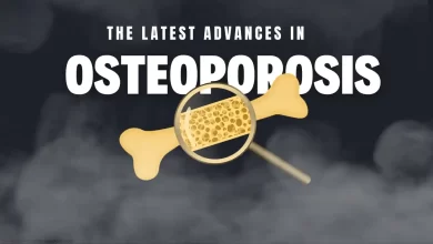 The Latest Advances in Osteoporosis