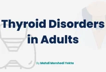Thyroid Disorders in Adults