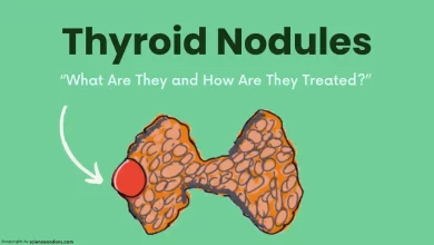 Thyroid Nodules Symptoms Diagnosed & Treatment