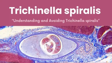 Trichinosis & Trichinella Spiralis