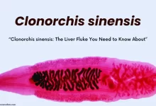 Clonorchis sinensis