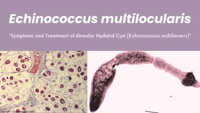 Echinococcus multilocularis