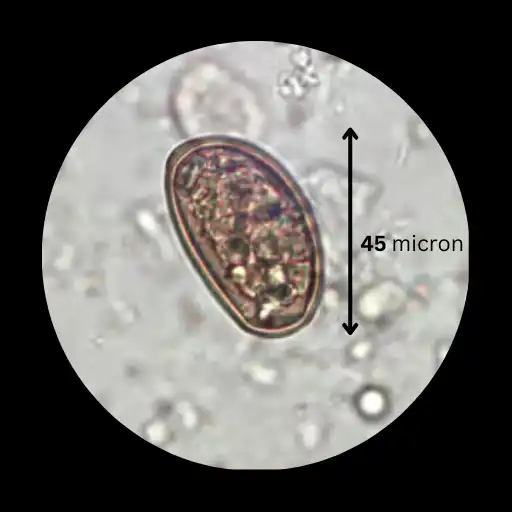 eggs of Dicrocoelium dendriticum