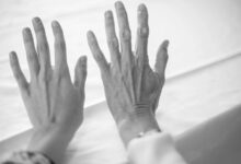 cellular-aging-mechanisms